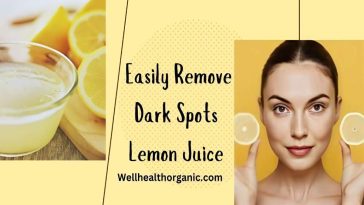 Wellhealthorganic.Com_Lemon-Juice-Know-Home-Remedies-Easily-Remove-Dark-Spots
